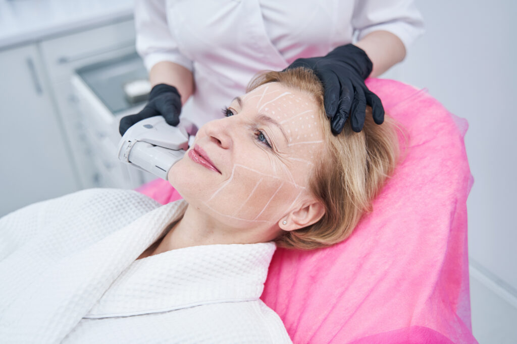 Close up of woman getting High-Intensity Focused ultrasound face lifting treatment with professional equipment in med spa