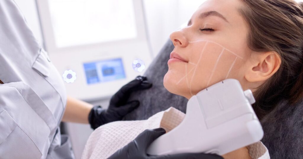 someone getting hifu 1024x538 1