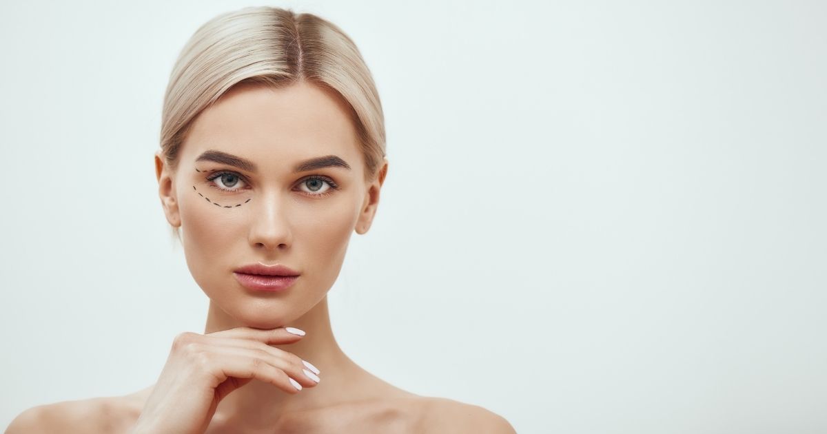 Woman with under-eye treatment markings highlighting the tear trough area.